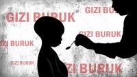65 Anak di Aceh Utara Alami Gizi Buruk, Kecamatan Nisam Tertinggi